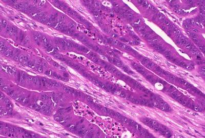 Sample image from GlaS@MICCAI'2015: Gland Segmentation