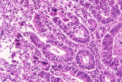 Sample image from GlaS@MICCAI'2015: Gland Segmentation