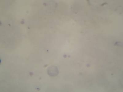 Sample image from Microscopy Malaria Dataset