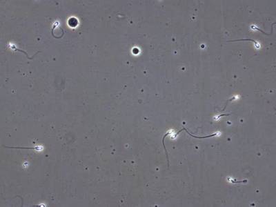 Sample image from VISEM-Tracking