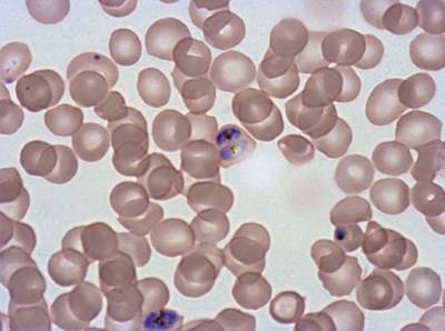 Sample image from Plasmodium Falciparum from Images of Giemsa for Malaria Detection