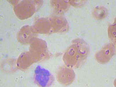 Sample image from BCCD