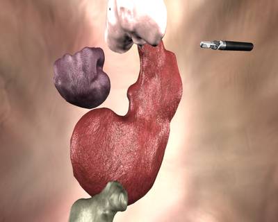 Sample image from SISVSE