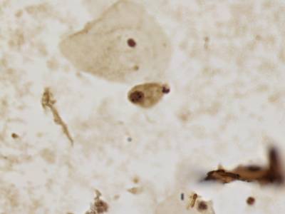 Sample image from CCAgT