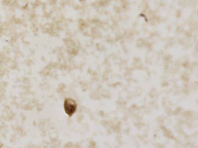 Sample image from CCAgT