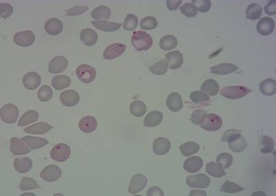 Sample image from BBBC041Seg