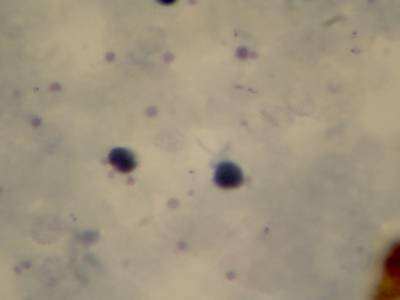 Sample image from Microscopy Malaria Dataset