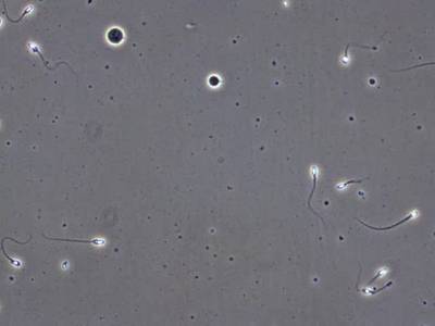 Sample image from VISEM-Tracking