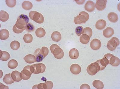 Sample image from Plasmodium Falciparum from Images of Giemsa for Malaria Detection