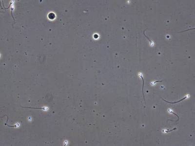 Sample image from VISEM-Tracking