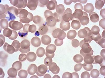 Sample image from Plasmodium Falciparum from Images of Giemsa for Malaria Detection