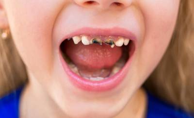 Sample image from Dentalai