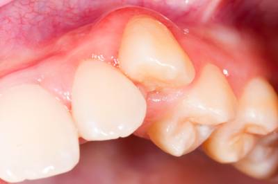 Sample image from Dentalai