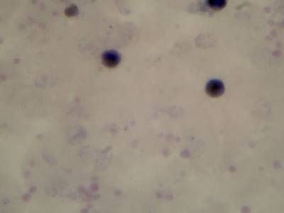 Sample image from Microscopy Malaria Dataset