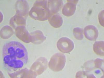 Sample image from BCCD
