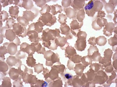 Sample image from Plasmodium Falciparum from Images of Giemsa for Malaria Detection