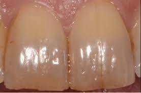 Sample image from Dentalai
