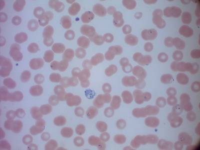 Sample image from MP IDB