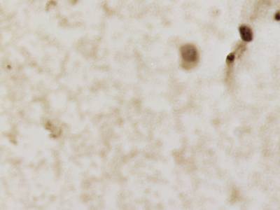 Sample image from CCAgT