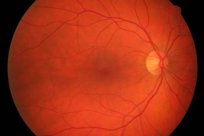 Sample image from High Resolution Fundus