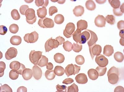 Sample image from Plasmodium Falciparum from Images of Giemsa for Malaria Detection