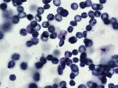 Sample image from BBBC041Seg