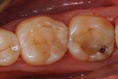 Sample image from Dentalai