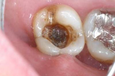 Sample image from Dentalai