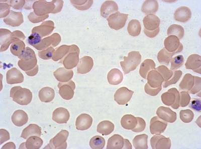 Sample image from Plasmodium Falciparum from Images of Giemsa for Malaria Detection