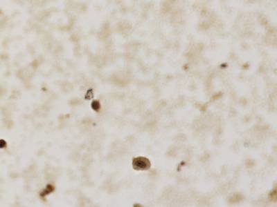 Sample image from CCAgT