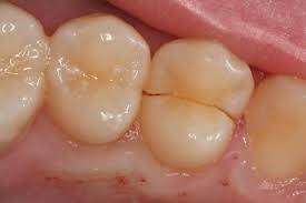 Sample image from Dentalai