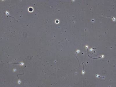 Sample image from VISEM-Tracking