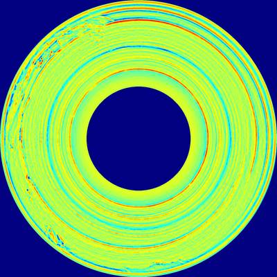 Sample image from BTAD