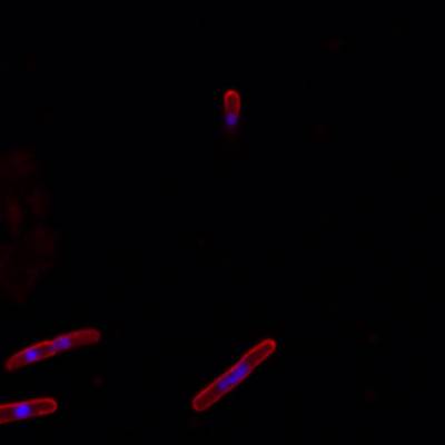 Sample image from DeepBacs E. Coli