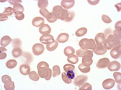 Sample image from Plasmodium Falciparum from Images of Giemsa for Malaria Detection