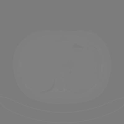 Sample image from DeepLesion
