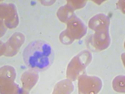 Sample image from BCCD