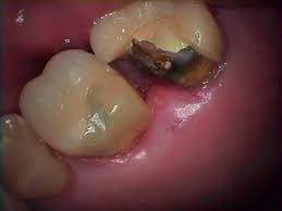Sample image from Dentalai