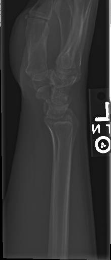 Sample image from Bone Classification and Detection Dataset