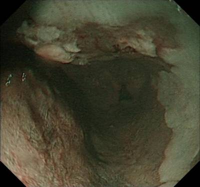 Sample image from EDD2020