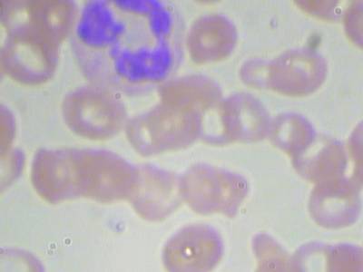 Sample image from BCCD