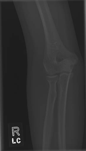 Sample image from Bone Classification and Detection Dataset