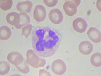 Sample image from BCCD