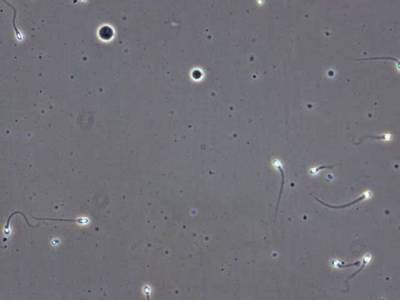 Sample image from VISEM-Tracking
