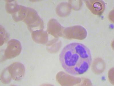 Sample image from BCCD