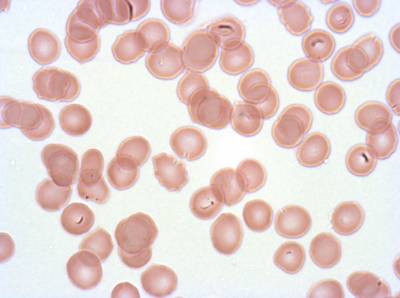 Sample image from Plasmodium Falciparum from Images of Giemsa for Malaria Detection