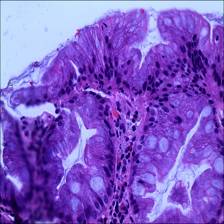 Sample image from EBHI-Seg