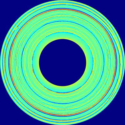 Sample image from BTAD