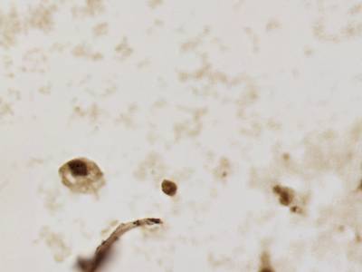 Sample image from CCAgT