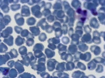 Sample image from Plasmodium Falciparum from Images of Giemsa for Malaria Detection